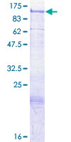 SGIP1 Protein - 12.5% SDS-PAGE of human SGIP1 stained with Coomassie Blue
