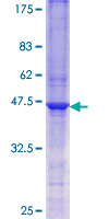 SGK1 / SGK Protein - 12.5% SDS-PAGE Stained with Coomassie Blue.