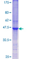 SGK1 / SGK Protein - 12.5% SDS-PAGE Stained with Coomassie Blue.