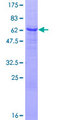 SGK2 Protein - 12.5% SDS-PAGE of human SGK2 stained with Coomassie Blue