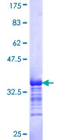 SGK2 Protein - 12.5% SDS-PAGE Stained with Coomassie Blue.