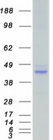 SGK2 Protein - Purified recombinant protein SGK2 was analyzed by SDS-PAGE gel and Coomassie Blue Staining