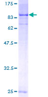 SGK3 Protein - 12.5% SDS-PAGE of human SGKL stained with Coomassie Blue