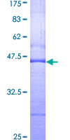 SGK3 Protein - 12.5% SDS-PAGE Stained with Coomassie Blue.