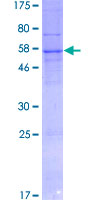 SGK494 Protein - 12.5% SDS-PAGE of human FLJ25006 stained with Coomassie Blue