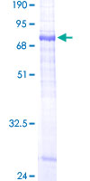 SGMS1 / TMEM23 Protein - 12.5% SDS-PAGE of human TMEM23 stained with Coomassie Blue