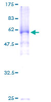 SGOL1 / Shugoshin Protein - 12.5% SDS-PAGE of human SGOL1 stained with Coomassie Blue