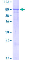 SGPL1 Protein - 12.5% SDS-PAGE of human SGPL1 stained with Coomassie Blue
