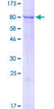SGPL1 Protein - 12.5% SDS-PAGE of human SGPL1 stained with Coomassie Blue