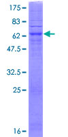 SGPP2 Protein - 12.5% SDS-PAGE of human SGPP2 stained with Coomassie Blue