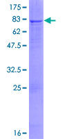 SGSH Protein - 12.5% SDS-PAGE of human SGSH stained with Coomassie Blue