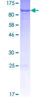 SGSM3 Protein - 12.5% SDS-PAGE of human SGSM3 stained with Coomassie Blue