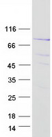 SGSM3 Protein - Purified recombinant protein SGSM3 was analyzed by SDS-PAGE gel and Coomassie Blue Staining