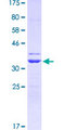 SGTA / SGT Protein - 12.5% SDS-PAGE Stained with Coomassie Blue.