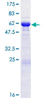 SGTB Protein - 12.5% SDS-PAGE of human SGTB stained with Coomassie Blue