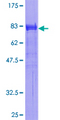 SH2B1 Protein - 12.5% SDS-PAGE of human SH2B stained with Coomassie Blue
