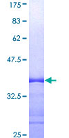SH2B1 Protein - 12.5% SDS-PAGE Stained with Coomassie Blue.
