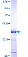 SH2B2 / APS Protein - 12.5% SDS-PAGE Stained with Coomassie Blue.