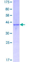 SH2D1A / SAP Protein - 12.5% SDS-PAGE of human SH2D1A stained with Coomassie Blue