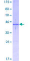 SH2D1A / SAP Protein - 12.5% SDS-PAGE of human SH2D1A stained with Coomassie Blue