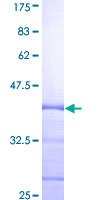 SH2D2A Protein - 12.5% SDS-PAGE Stained with Coomassie Blue.