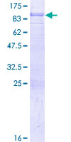 SH2D3A / NSP1 Protein - 12.5% SDS-PAGE of human SH2D3A stained with Coomassie Blue