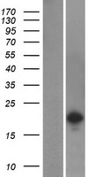 SH2D6 Protein - Western validation with an anti-DDK antibody * L: Control HEK293 lysate R: Over-expression lysate