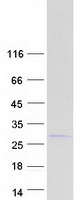 SH2D6 Protein - Purified recombinant protein SH2D6 was analyzed by SDS-PAGE gel and Coomassie Blue Staining