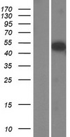 SH2D7 Protein - Western validation with an anti-DDK antibody * L: Control HEK293 lysate R: Over-expression lysate
