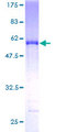 SH3BGR Protein - 12.5% SDS-PAGE of human SH3BGR stained with Coomassie Blue