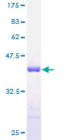 SH3BGRL Protein - 12.5% SDS-PAGE of human SH3BGRL stained with Coomassie Blue