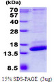 SH3BGRL2 Protein