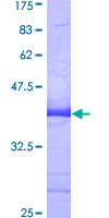 SH3BP2 Protein - 12.5% SDS-PAGE Stained with Coomassie Blue.