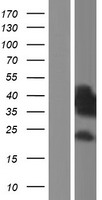 SH3BP5 / SAB Protein - Western validation with an anti-DDK antibody * L: Control HEK293 lysate R: Over-expression lysate