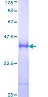 SH3BP5 / SAB Protein - 12.5% SDS-PAGE Stained with Coomassie Blue.