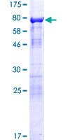SH3BP5L Protein - 12.5% SDS-PAGE of human SH3BP5L stained with Coomassie Blue