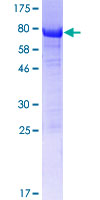 SH3D19 Protein - 12.5% SDS-PAGE of human SH3D19 stained with Coomassie Blue