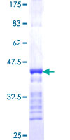 SH3D19 Protein - 12.5% SDS-PAGE Stained with Coomassie Blue.