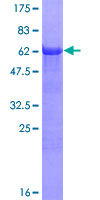 SH3GL2 Protein - 12.5% SDS-PAGE of human SH3GL2 stained with Coomassie Blue