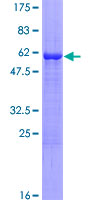 SH3GL3 Protein - 12.5% SDS-PAGE of human SH3GL3 stained with Coomassie Blue