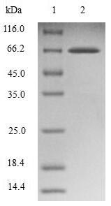 SH3GLB1 / Bif / Endophilin B1 Protein - (Tris-Glycine gel) Discontinuous SDS-PAGE (reduced) with 5% enrichment gel and 15% separation gel.