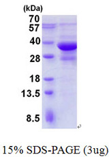 SH3GLB1 / Bif / Endophilin B1 Protein