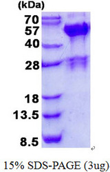 SH3GLB2 / Endophilin-B2 Protein