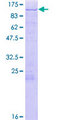 SH3KBP1 / CIN85 Protein - 12.5% SDS-PAGE of human SH3KBP1 stained with Coomassie Blue