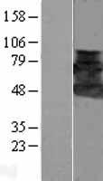 SH3P7 / HIP-55 Protein - Western validation with an anti-DDK antibody * L: Control HEK293 lysate R: Over-expression lysate