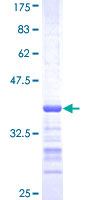 SH3RF2 Protein - 12.5% SDS-PAGE Stained with Coomassie Blue.