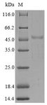 SH3YL1 Protein - (Tris-Glycine gel) Discontinuous SDS-PAGE (reduced) with 5% enrichment gel and 15% separation gel.