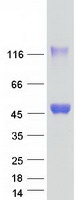 SHARPIN Protein - Purified recombinant protein SHARPIN was analyzed by SDS-PAGE gel and Coomassie Blue Staining
