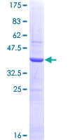 SHBG Protein - 12.5% SDS-PAGE Stained with Coomassie Blue.