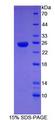 SHBG Protein - Recombinant Sex Hormone Binding Globulin By SDS-PAGE